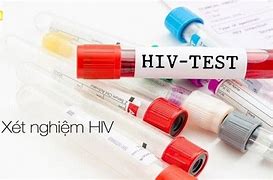 Xét Nghiệm Hiv Ở Đâu Hà Nội